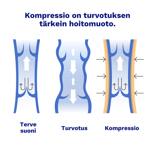 kompressio-infografiikka.png